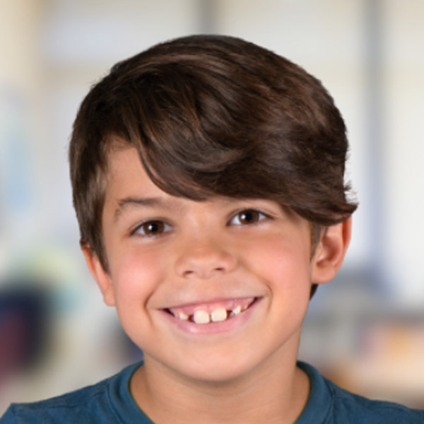 A young boy with a charming smile displays a playful attitude, showcasing his missing tooth.